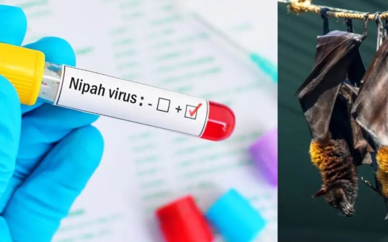 Kolkata Hospital Admits Youth Returning from Kerala with Nipah Virus-like Symptoms